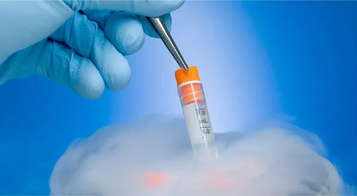 Lưu trữ Trứng - Tinh Trùng