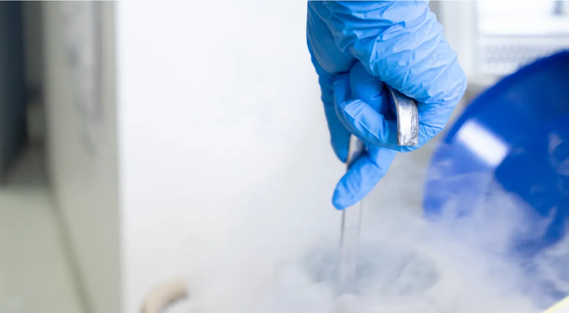 Lưu trữ Trứng - Tinh Trùng