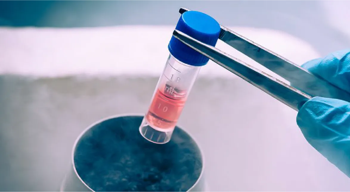 Lưu trữ Trứng - Tinh Trùng