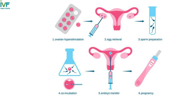 Thụ tinh ống nghiệm IVF có lợi ích gì ? Giải đáp tất tần tật về IVF