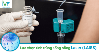 Lựa chọn tinh trùng sống bằng Laser sẽ như thế nào?