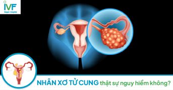 NHÂN XƠ TỬ CUNG có thật sự nguy hiểm không?