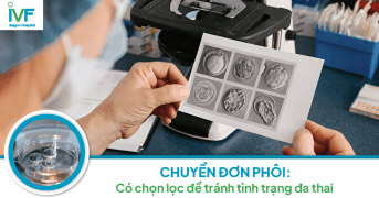 CHUYỂN ĐƠN PHÔI: Có chọn lọc để tránh tình trạng đa thai