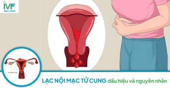 Lạc nội mạc tử cung: Dấu hiệu và nguyên nhân nhận biết thế nào?