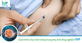 Quá Trình Chọc Hút Trứng Khi Thụ Tinh Trong Ống Nghiệm IVF 