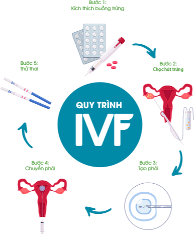 Quy trình IVF-SG