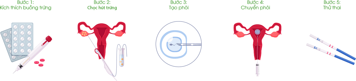 Quy trình IVF-SG