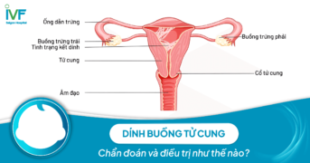 Dính buồng tử cung: Chẩn đoán và điều trị thế nào?