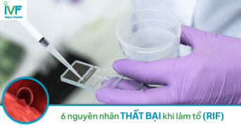 Nguyên nhân dẫn đến thất bại làm tổ ( RIF) trong thụ tinh ống nghiệm