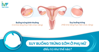  Suy Buồng Trứng Sớm Ở Phụ Nữ Làm Thế Nào?