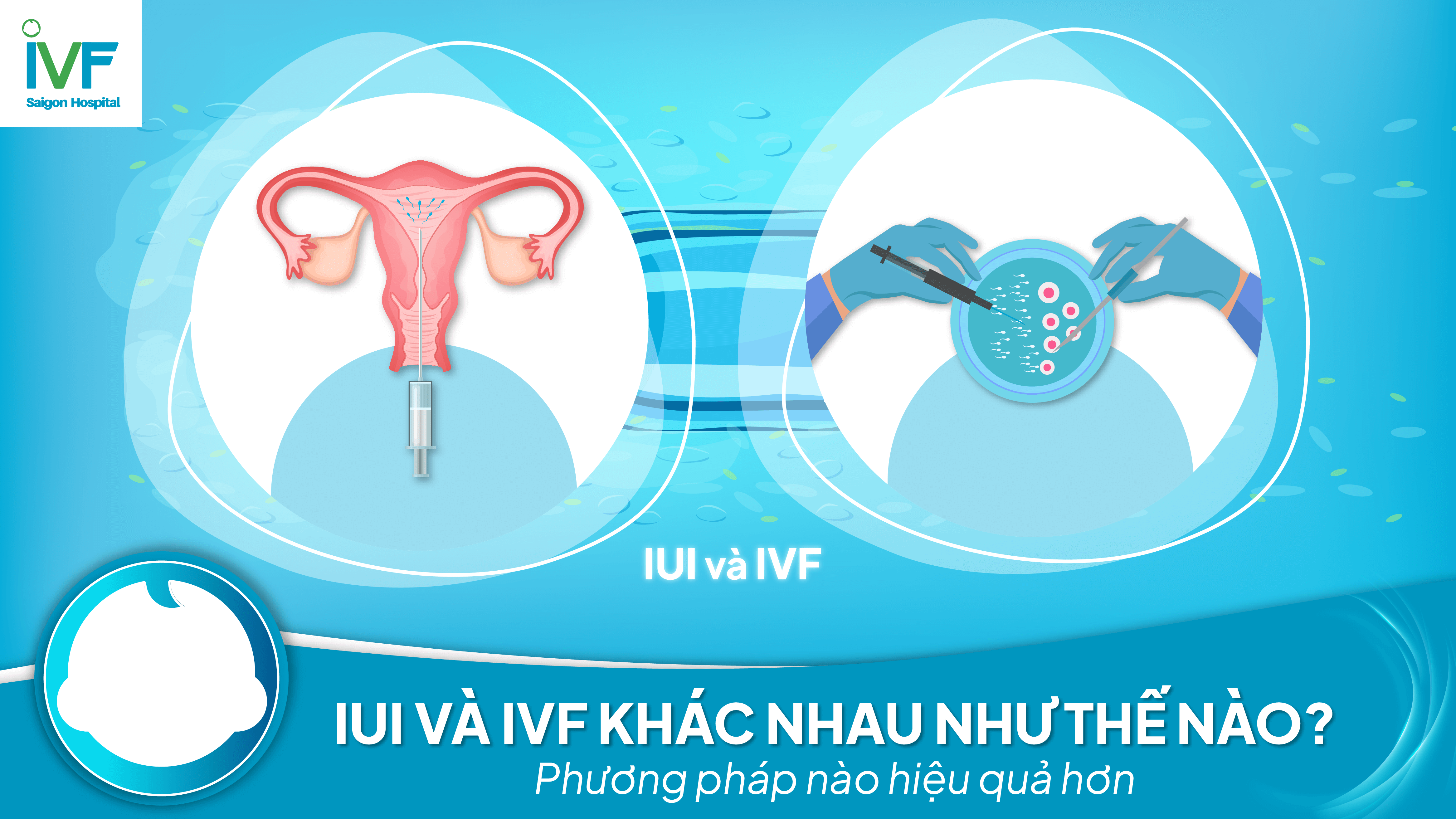 Thụ tinh nhân tạo khác gì thụ tinh ống nghiệm?