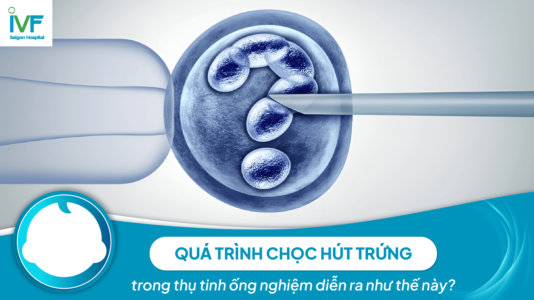 QUÁ TRÌNH CHỌC HÚT TRỨNG diễn ra thế nào?