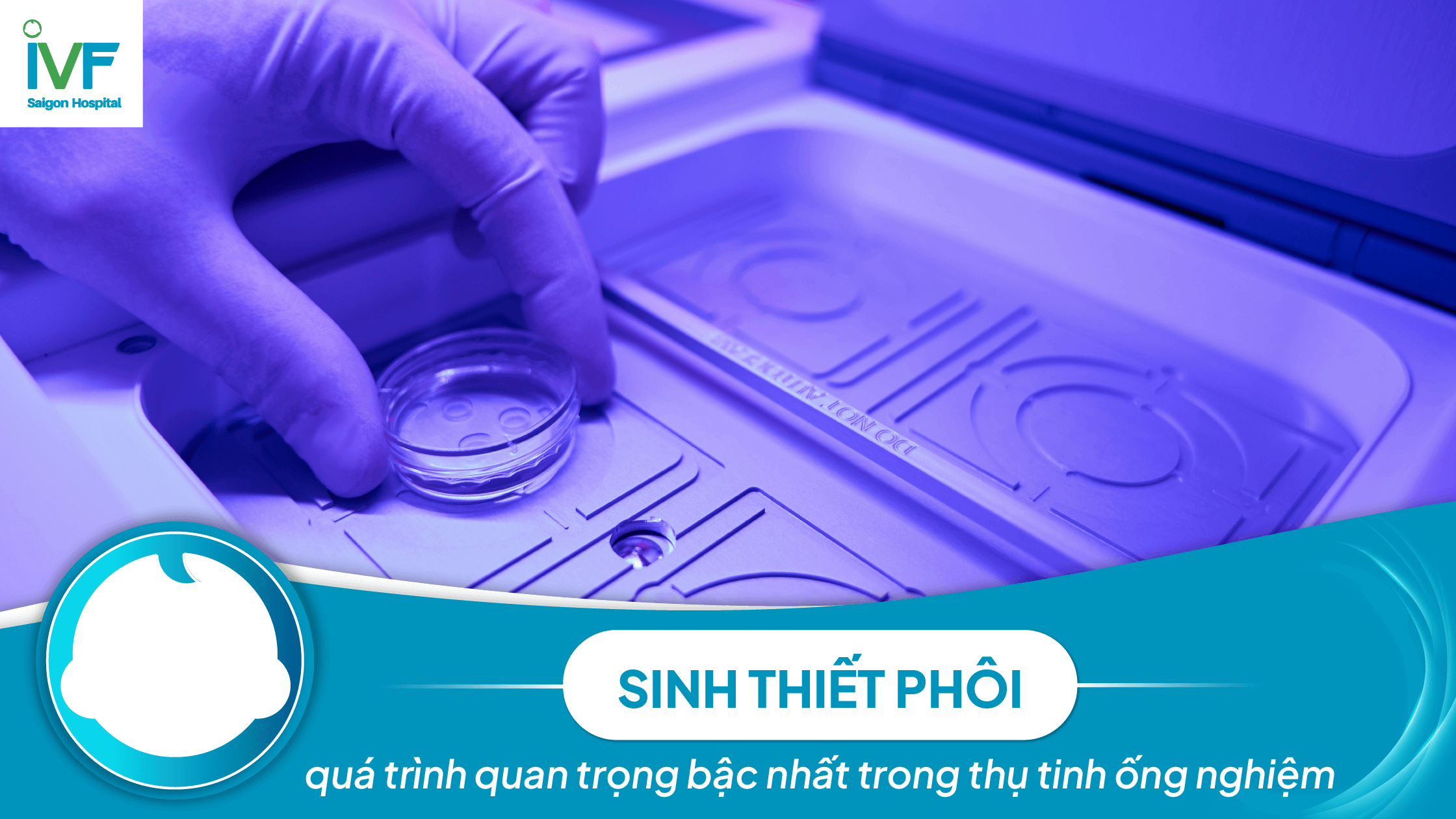 SINH THIẾT PHÔI - thứ quan trọng bậc nhất IVF