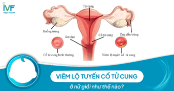 Viêm lộ tuyến cổ tử cung và những điều bạn cần biết