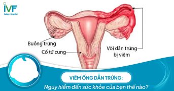 Viêm ống dẫn trứng nguy hiểm đến sức khỏe của bạn thế nào?