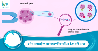 Xét nghiệm di truyền tiền làm tổ PGT và những điều bạn cần biết