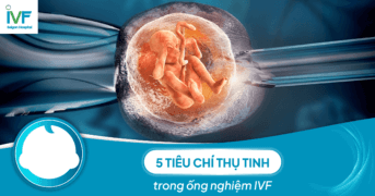 5 tiêu chí thụ tinh trong ống nghiệm và lựa chọn nơi thăm khám 