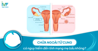 Chửa ngoài tử cung có nguy hiểm đến tính mạng mẹ bầu không?