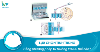 Lựa chọn tinh trùng: Bằng phương pháp từ trường MACS thế nào?