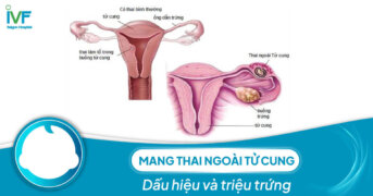 Thai ngoài tử cung: Dấu hiệu, nguyên nhân và triệu chứng thế nào?