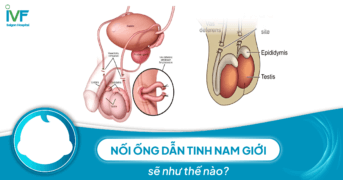 Nối ống dẫn tinh nam giới được thực hiện như thế nào?