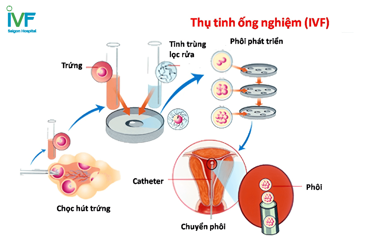 chi phí thụ tinh trong ống nghiệm