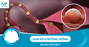 Quá kích buồng trứng: Biến chứng và những nỗi lo khi điều trị hiếm muộn 