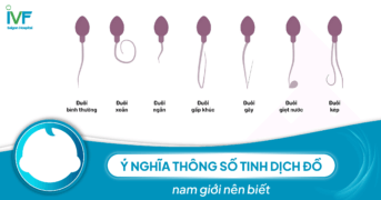 Ý nghĩa thông số tinh dịch đồ nam giới nên biết