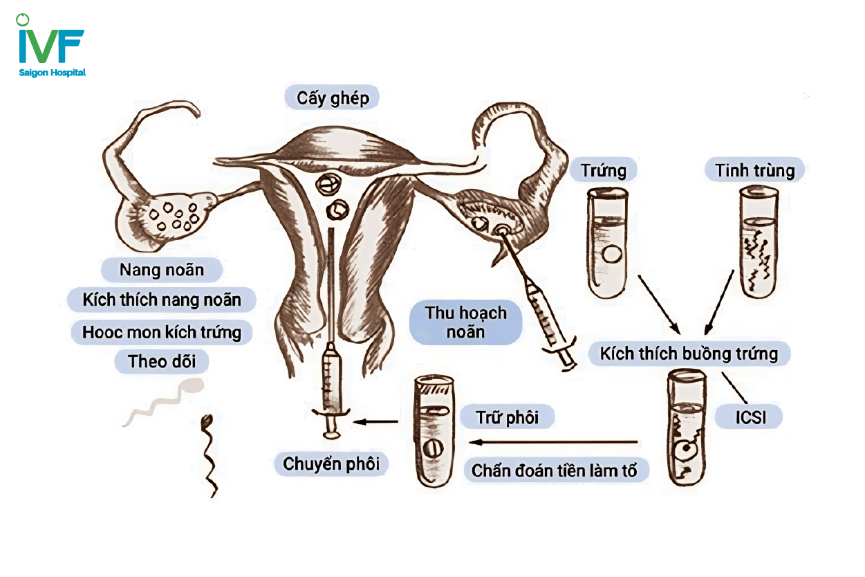 lợi ích chọc hút trứng