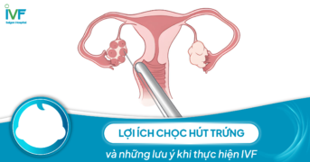 Lợi ích chọc hút trứng và những lưu ý khi thực hiện IVF