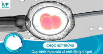 Chọc hút trứng: Quy trình thực hiện và chế độ nghỉ ngơi