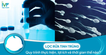 Lọc rửa tinh trùng: Quy trình thực hiện, lợi ích và thời gian thế nào?