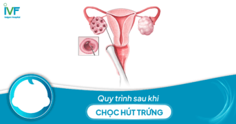 Quy trình sau chọc hút trứng và những lưu ý dành cho bạn