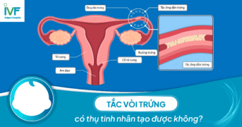 Tắc vòi trứng có thụ tinh nhân tạo được không?