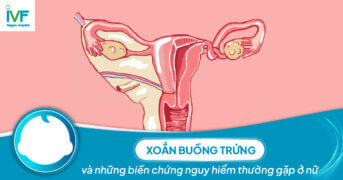 Xoắn buồng trứng và những biến chứng thường gặp ở nữ