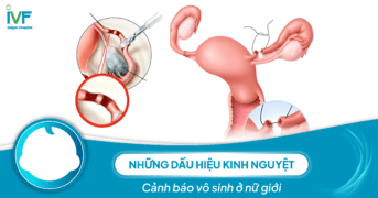 Những dấu hiệu kinh nguyệt cảnh báo vô sinh ở nữ giới