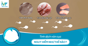 Tinh dịch vón cục nguy hiểm như thế nào?