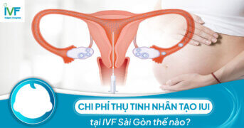 Chi phí thụ tinh nhân tạo IUI tại IVF Sài Gòn thế nào?