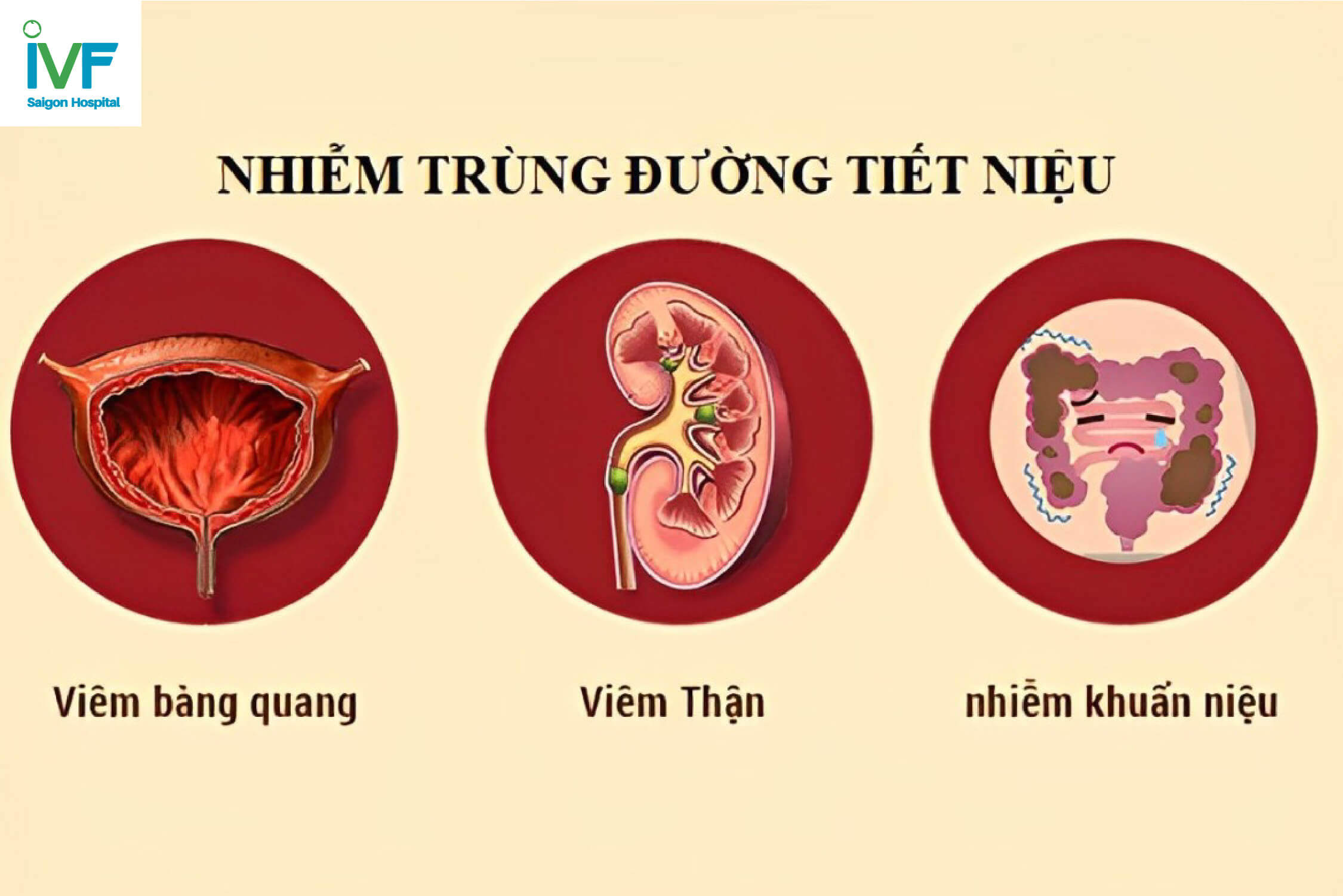 nhiễm trùng tiết niệu