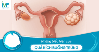 Những biểu hiện của quá kích buồng trứng