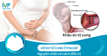 Hở eo tử cung ở phụ nữ: Nguyên nhân và cách điều trị