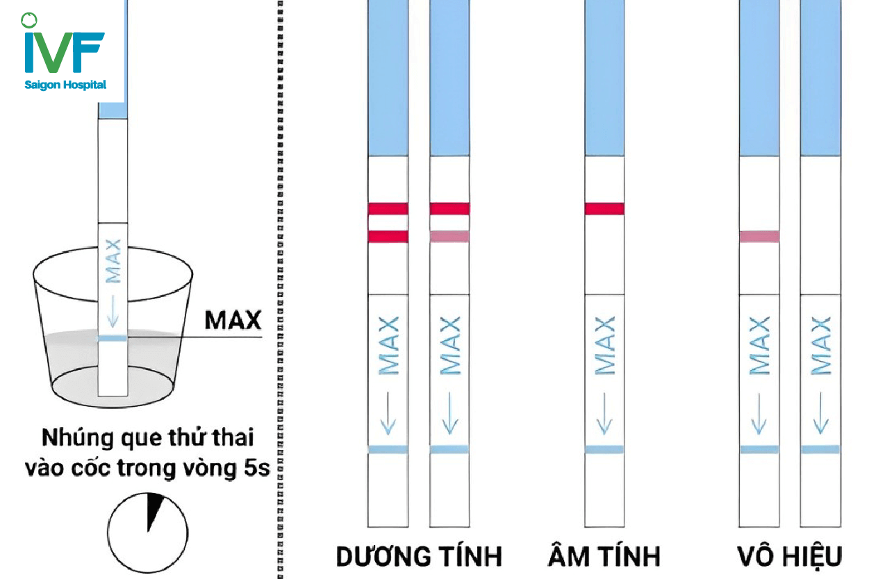 cac-buoc-su-dung-que-thu-thai