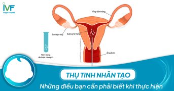 Thụ tinh nhân tạo: Những điều bạn cần phải biết khi thực hiện