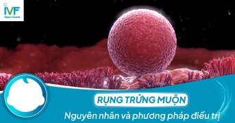 Rụng trứng muộn: Nguyên nhân và phương pháp điều trị