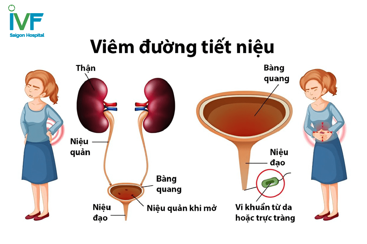 thuong-xuyen-nhin-tieu