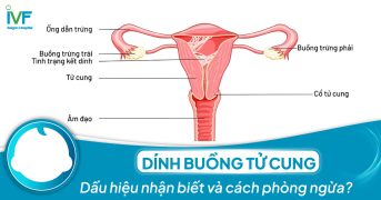 Dính buồng tử cung: Dấu hiệu nhận biết và cách phòng ngừa?