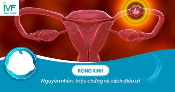 Rong kinh: Nguyên nhân, triệu chứng và cách điều trị