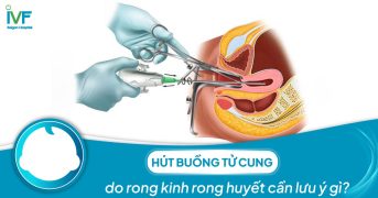 Hút buồng tử cung do rong kinh rong huyết cần lưu ý gì?