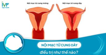 Nội mạc tử cung dày điều trị như thế nào?