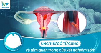 Ung thư cổ tử cung và tầm quan trọng của xét nghiệm sớm